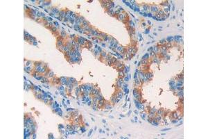 Figure. (DPP8 antibody  (AA 1-199))