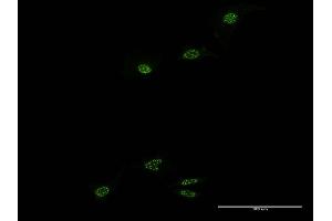 Immunofluorescence of monoclonal antibody to NR1D1 on HeLa cell. (NR1D1 antibody  (AA 233-322))