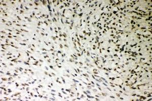 IHC analysis of SMURF1 using anti-SMURF1 antibody (ABIN3044547). (SMURF1 antibody  (Middle Region))