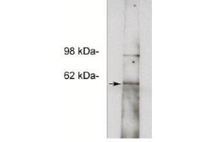 Image no. 1 for anti-Notum Pectinacetylesterase Homolog (NOTUM) antibody (ABIN265168) (NOTUM antibody)
