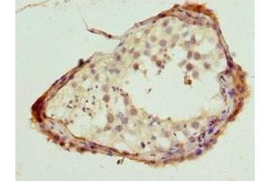 Immunohistochemistry of paraffin-embedded human testis tissue using ABIN7169125 at dilution of 1:100 (Nemo-Like Kinase antibody  (AA 278-527))