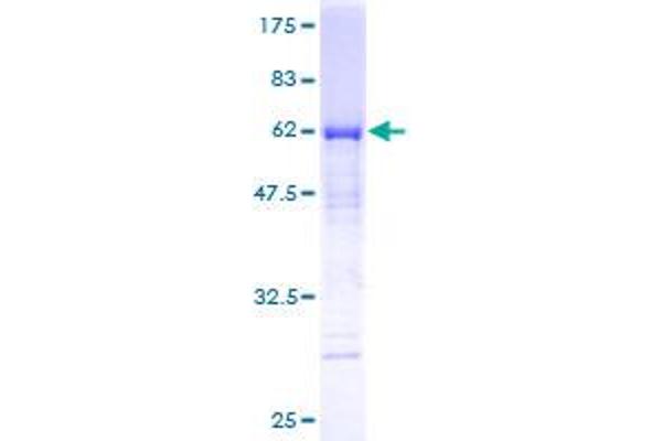 MTUS1 Protein (AA 1-240) (GST tag)