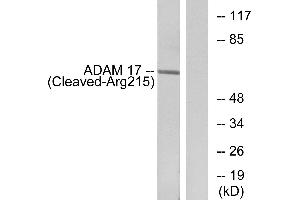 Western blot analysis of extracts from rat liver cells, using ADAM 17 (Cleaved-Arg215) antibody. (ADAM17 antibody  (Cleaved-Arg215))