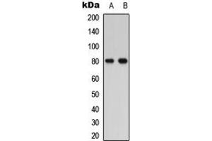 Western blot analysis of PTHR1 expression in HEK293T (A), COLO205 (B) whole cell lysates. (PTH1R antibody  (Center))