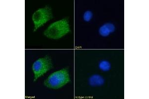 Immunofluorescence staining of A549 cells using anti-RAGE antibody  2A11. (Recombinant RAGE antibody)