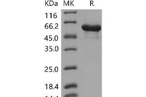 Western Blotting (WB) image for Heat Shock 60kDa Protein 1 (Chaperonin) (HSPD1) protein (His tag) (ABIN7320221) (HSPD1 Protein (His tag))