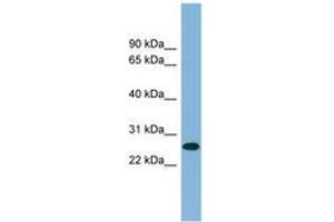 Image no. 1 for anti-serine/arginine-Rich Splicing Factor 12 (SRSF12) (AA 179-228) antibody (ABIN6742016) (SRSF12 antibody  (AA 179-228))