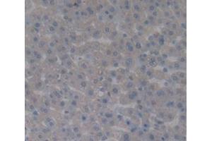 IHC-P analysis of Rat Tissue, with DAB staining. (Complement Factor B antibody  (AA 34-159))