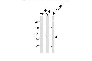 All lanes : Anti-TLR2 Antibody at 1:500-1:1000 dilution Lane 1: Ramos whole cell lysate Lane 2: A549 whole cell lysate Lane 3: MDA-MB-231 whole cell lysate Lysates/proteins at 20 μg per lane. (TLR2 antibody)