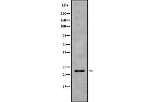 Western blot analysis of HP1gamma using 293 whole cell lysates (CBX3 antibody  (Internal Region))