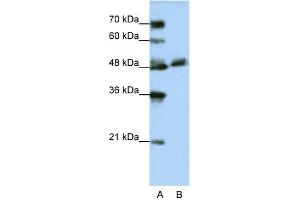 WB Suggested Anti-WDR13 Antibody Titration:  1. (WDR13 antibody  (N-Term))