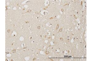 Immunoperoxidase of purified MaxPab antibody to USP3 on formalin-fixed paraffin-embedded human cerebral cortex. (USP3 antibody  (AA 1-520))