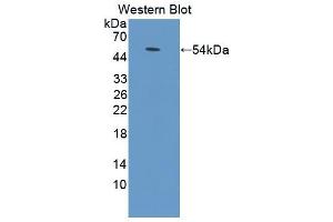 Western blot analysis of the recombinant protein. (ADCY9 antibody  (AA 852-1065))