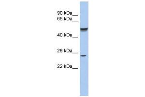 WB Suggested Anti-PHOX2A Antibody Titration:  0. (PHOX2A antibody  (N-Term))