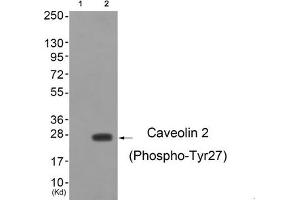 Western blot analysis of extracts from cos-7 cells (Lane 2), using Caveolin 2 (Phospho-Tyr27) Antibody. (Caveolin 2 antibody  (pTyr27))