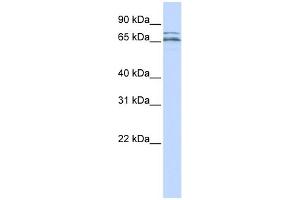 WB Suggested Anti-CACNB2 Antibody Titration:  0. (CACNB2 antibody  (Middle Region))