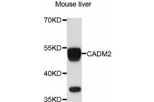 Western blot analysis of extracts of mouse liver, using CADM2 antibody (ABIN4903105) at 1:3000 dilution.