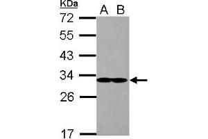 Image no. 2 for anti-Eukaryotic Translation Initiation Factor 2B, Subunit 1 Alpha, 26kDa (EIF2B1) (AA 1-305) antibody (ABIN1497966) (EIF2B1 antibody  (AA 1-305))