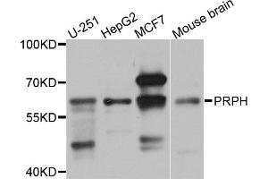 Western blot analysis of extracts of various cell lines, using PRPH antibody. (Peripherin antibody)