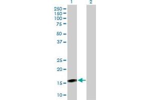 Western Blot analysis of BST2 expression in transfected 293T cell line by BST2 MaxPab polyclonal antibody. (BST2 antibody  (AA 40-180))