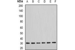 Western blot analysis of DDAH2 expression in SW620 (A), MCF7 (B), mouse lung (C), mouse kidney (D), rat heart (E), rat brain (F) whole cell lysates. (DDAH2 antibody)