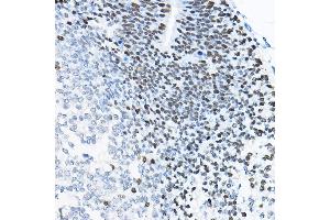 Immunohistochemistry of paraffin-embedded mouse fetal Brain using SOX2 Rabbit pAb (ABIN6130648, ABIN6148295, ABIN6148297 and ABIN6215241) at dilution of 1:100 (40x lens). (SOX2 antibody  (AA 1-140))