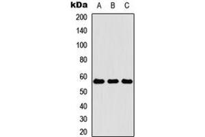 Western blot analysis of Cytokeratin 4 expression in HEK293T (A), Raw264.