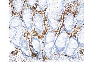 Immunohistochemistry (IHC) image for anti-CD38 (AA 43-300) antibody (ABIN7453961) (Recombinant CD38 antibody  (AA 43-300))