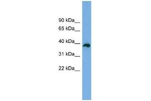 WB Suggested Anti-DEDD2 Antibody Titration: 0. (DEDD2 antibody  (Middle Region))
