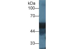 Western blot analysis of Rat Liver lysate, using Rat DBP Antibody (1 µg/ml) and HRP-conjugated Goat Anti-Rabbit antibody ( (Vitamin D-Binding Protein antibody  (AA 395-475))