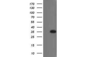 Image no. 1 for anti-RING1 and YY1 Binding Protein (RYBP) antibody (ABIN1500776) (RYBP antibody)