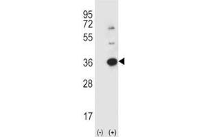 Western blot analysis using anti-Caspase-3 antibody and 293 cell lysate (2 ug/lane) either nontransfected (Lane 1) or transiently transfected (2) with the CASP3 gene. (Caspase 3 antibody  (AA 60-90))