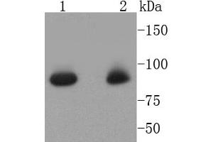 Lane 1: Hela, Lane 2: K562 cell lysates, probed with STAT5a (6E5) Monoclonal Antibody  at 1:1000 overnight at 4˚C. (STAT5A antibody)