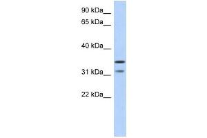 C17ORF81 antibody used at 1 ug/ml to detect target protein.