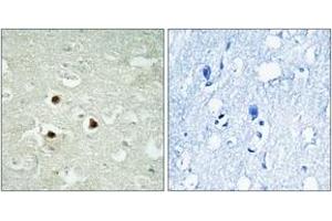 Immunohistochemistry analysis of paraffin-embedded human brain tissue, using RAB3IP Antibody. (RAB3IP antibody  (AA 257-306))