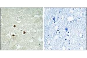 Immunohistochemistry analysis of paraffin-embedded human brain tissue, using RAB3IP Antibody.