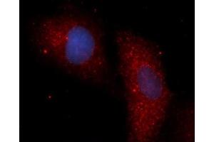 Immunofluorescence (IF) image for anti-Protein Phosphatase 1F (PP2C Domain Containing) (PPM1F) (AA 1-454) antibody (APC) (ABIN5568331)