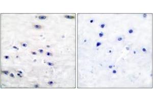 Immunohistochemistry analysis of paraffin-embedded human brain tissue, using Tyrosine Hydroxylase (Ab-19) Antibody. (Tyrosine Hydroxylase antibody  (AA 10-59))