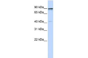 WB Suggested Anti-CCNT1 Antibody Titration:  0. (Cyclin T1 antibody  (N-Term))