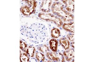 PDZK1 Antibody immunohistochemistry analysis in formalin fixed and paraffin embedded human kidney tissue followed by peroxidase conjugation of the secondary antibody and DAB staining. (PDZK1 antibody  (AA 196-224))