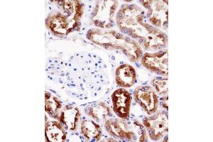 PDZK1 Antibody immunohistochemistry analysis in formalin fixed and paraffin embedded human kidney tissue followed by peroxidase conjugation of the secondary antibody and DAB staining.