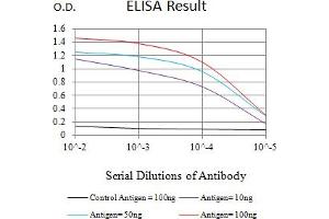 Black line: Control Antigen (100 ng),Purple line: Antigen (10 ng), Blue line: Antigen (50 ng), Red line:Antigen (100 ng) (Lysine (K)-Specific Methyltransferase 2B (KMT2B) (AA 445-599) antibody)