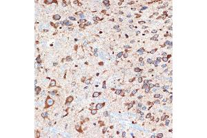 Immunohistochemistry of paraffin-embedded mouse spinal cord using  Rabbit mAb (ABIN7265453) at dilution of 1:100 (40x lens). (ADORA1 antibody)