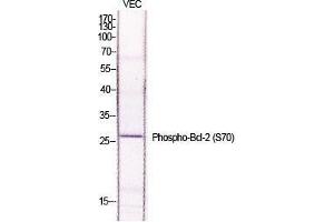 Western Blot (WB) analysis of specific cells using Phospho-Bcl-2 (S70) Polyclonal Antibody. (Bcl-2 antibody  (pSer70))