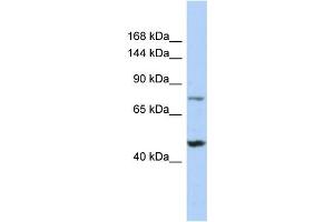 Host: Rabbit Target Name: MGA Sample Type: 721_B Whole Cell lysates Antibody Dilution: 1. (MGA (C-Term) antibody)