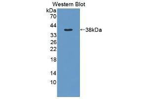 Detection of Recombinant MMP1, Rat using Polyclonal Antibody to Matrix Metalloproteinase 1 (MMP1) (MMP1 antibody  (AA 169-464))