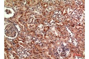 Immunohistochemistry (IHC) analysis of paraffin-embedded Human Kidney, antibody was diluted at 1:100. (CER1 antibody  (Internal Region))