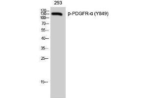 Western Blotting (WB) image for anti-Platelet Derived Growth Factor Receptor alpha (PDGFRA) (pTyr849) antibody (ABIN3182336) (PDGFRA antibody  (pTyr849))