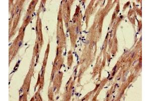 Immunohistochemistry of paraffin-embedded human heart tissue using ABIN7162571 at dilution of 1:100 (PNLIPRP3 antibody  (AA 201-467))