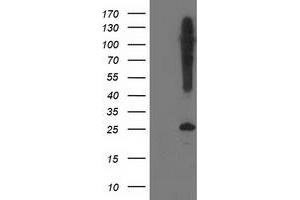 Western Blotting (WB) image for anti-Synaptosomal-Associated Protein, 25kDa (SNAP25) antibody (ABIN1501015) (SNAP25 antibody)